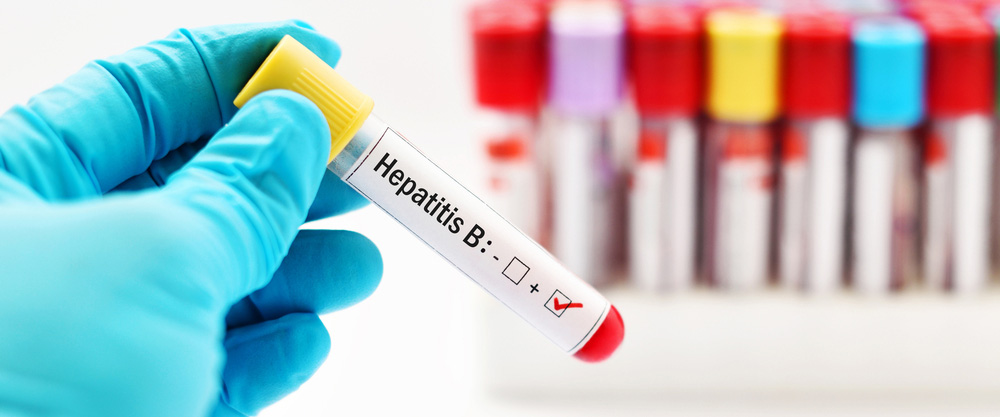 Šta je hepatitis B? Koji su simptomi i metode liječenja?